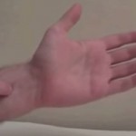 Muka vam je? Pritisnite ovu tačku na ruci i spriječićete povraćanje (VIDEO)